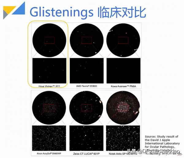 白內障手術應該如何選擇人工晶體?人工晶體有什麼不同 白內障手術應該如何選擇人工晶體?人工晶體有什麼不同