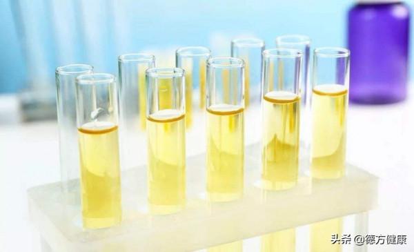 高友鶴教授：為什麼尿液是疾病早期標誌物的來源？