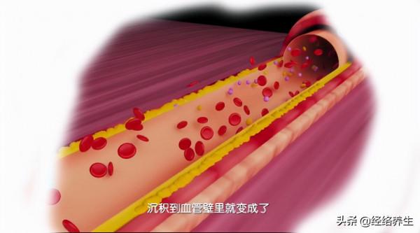 心梗的風險早知道,胃痛怎麼就變成了心梗?有這些症狀要仔細分辨 心梗的風險早知道,胃痛怎麼就變成了心梗?有這些症狀要仔細分辨