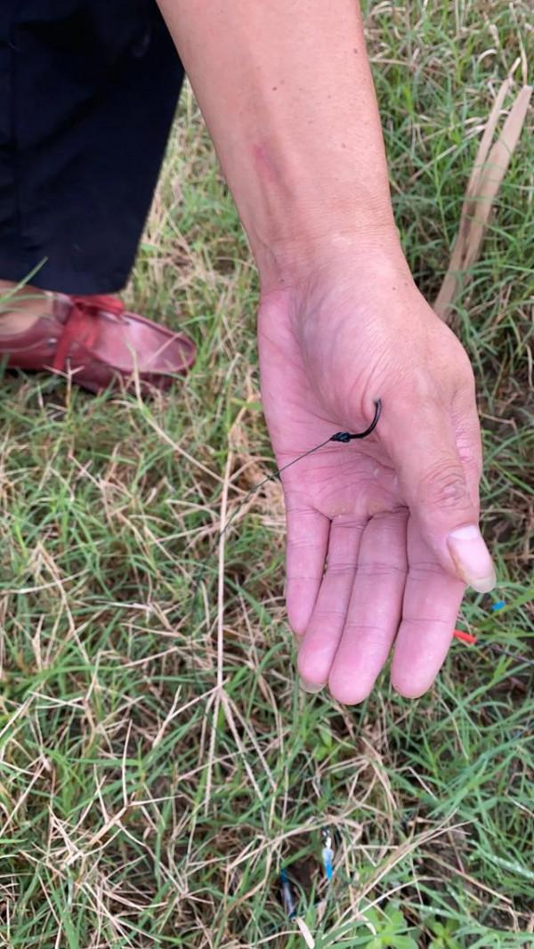 盤點釣魚人各種花式釣自己，看著就很疼！預防和處理方法分享