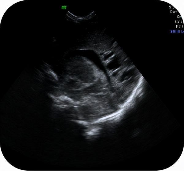 “綠色檢查”,護佑新生——新生兒顱腦超聲檢查 “綠色檢查”,護佑新生——新生兒顱腦超聲檢查