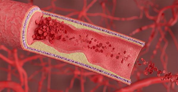 腐乳被稱為“東方乳酪”?對身體有益還是有害?看完長“姿勢”了 腐乳被稱為“東方乳酪”?對身體有益還是有害?看完長“姿勢”了