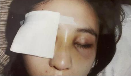 東北殘疾女孩嫁非洲富二代,相戀1年裸婚沒要彩禮,買不起尿不溼 東北殘疾女孩嫁非洲富二代,相戀1年裸婚沒要彩禮,買不起尿不溼