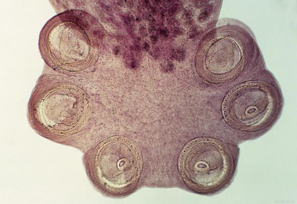 豬薑片吸蟲怎麼治