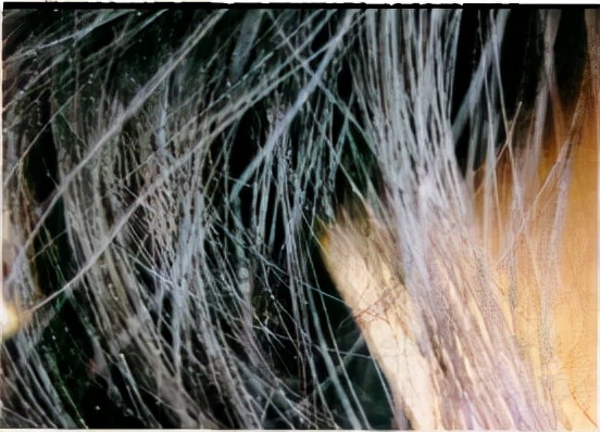 頭髮根部的小白點是什麼?掉了不能長出頭髮? 頭髮根部的小白點是什麼?掉了不能長出頭髮?