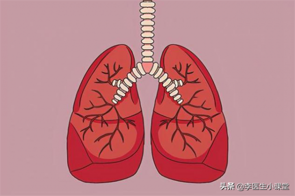 肺部疾病來臨前，會先經歷3個症狀！發現1個，建議及早就醫檢查