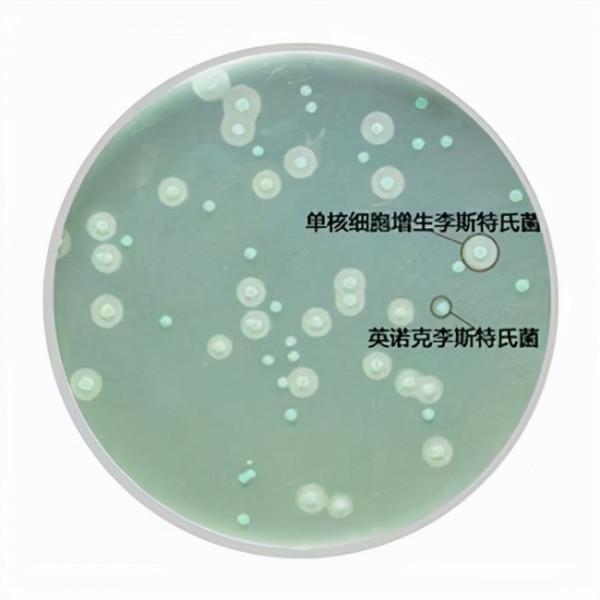 食源性致病菌,原來是你在搗亂 食源性致病菌,原來是你在搗亂