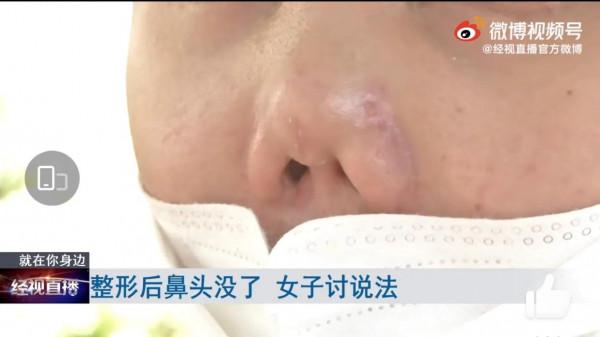 大無語事件,外貌焦慮竟然內捲到了肚臍眼… 大無語事件,外貌焦慮竟然內捲到了肚臍眼…