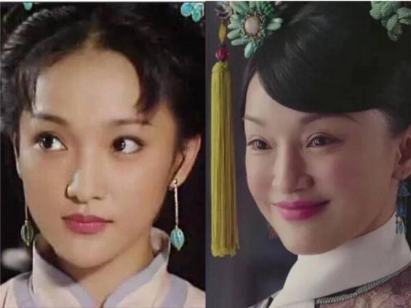 凹凸不平、眼睛擠成一條縫,“發麵饅頭”臉毀了多少高顏值明星? 凹凸不平、眼睛擠成一條縫,“發麵饅頭”臉毀了多少高顏值明星?