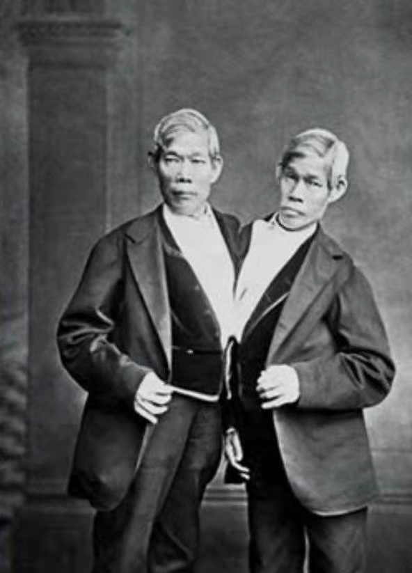 泰國連體兄弟，14歲被英國人帶到美國拍戲，從此一夜走紅