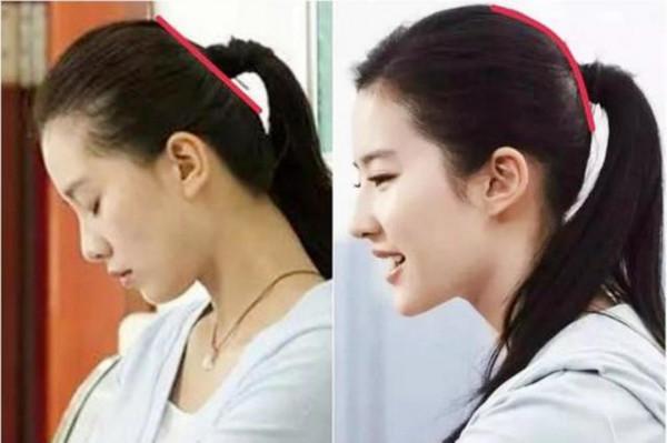 “扁頭”最扁能有多誇張？女孩曬照自嘲，圓頭才是孩子的福氣