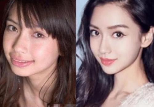 傅園慧整牙後&OpenCurlyDoubleQuote;洪荒少女&rdquo;變&OpenCurlyDoubleQuote;仙女&rdquo;，網友表示錯怪baby了