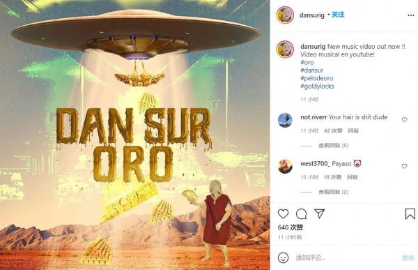 墨西哥Rapper頭皮植入數十條大金鍊，搞了一頭名副其實的金髮