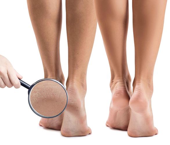 糖尿病足來臨前，雙腳或有4種異常表現，糖友們早知早好，別忽視