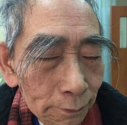 男人50歲以後，眉毛變長，意味著什麼呢？聽聽醫生是怎麼說的