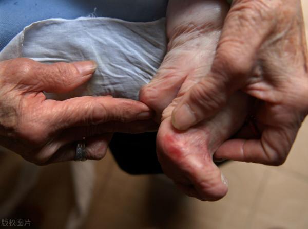 媽媽的四寸銀蓮（三）三寸金蓮起源於何時，纏足的真正推手是誰？