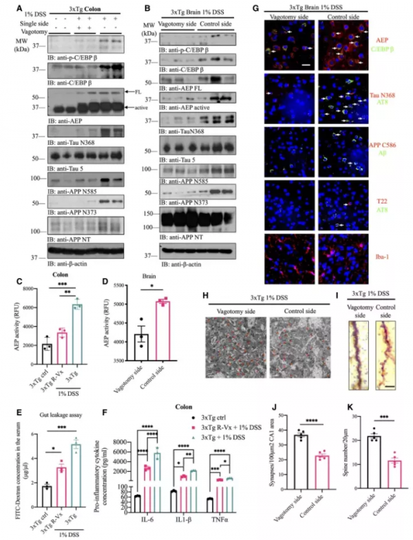 腸道炎症誘導C/EBPβ/δ分泌酶依賴性Aβ和Tau病理的對腦傳播 腸道炎症誘導C/EBPβ/δ分泌酶依賴性Aβ和Tau病理的對腦傳播