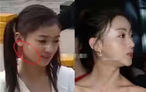 一刀削下頜骨整容法太可怕,看看舒淇俞飛鴻45+的狀態,方臉最牛 一刀削下頜骨整容法太可怕,看看舒淇俞飛鴻45+的狀態,方臉最牛