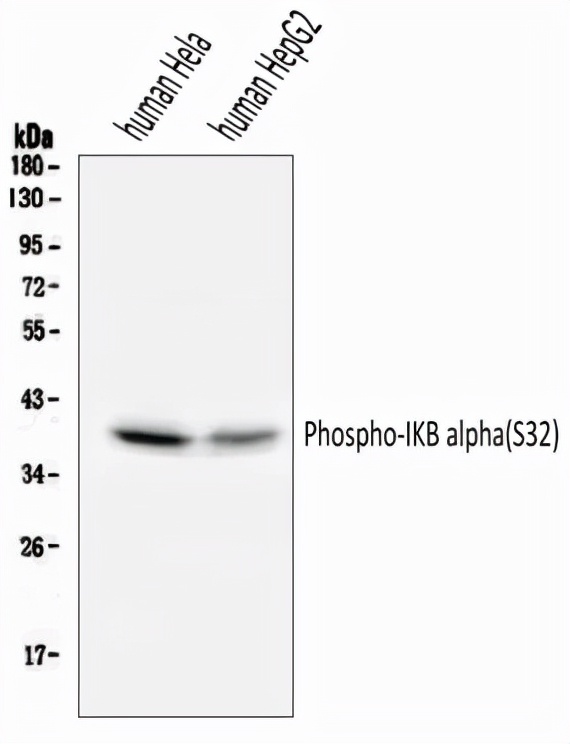 當磷酸化遇到 western blot，老司機教你這樣操作&period;&period;&period;