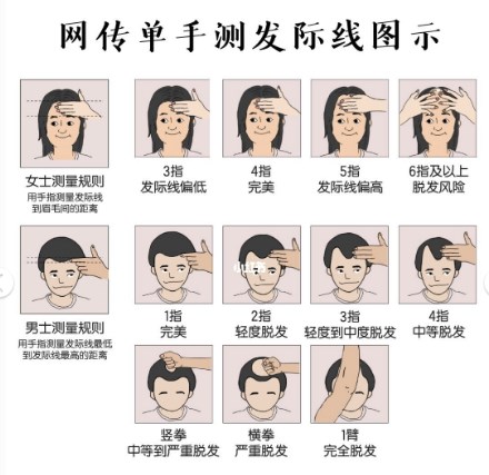 張柏芝測髮際線面板好到爆 三指髮際線太讓人羨慕