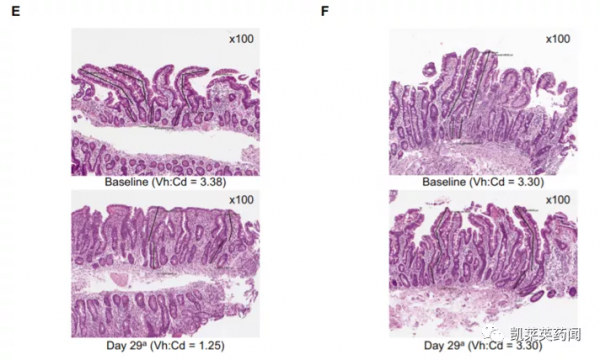 新藥巡禮：隱藏在冰山下的免疫疾病與創新奈米微球療法TAK-101