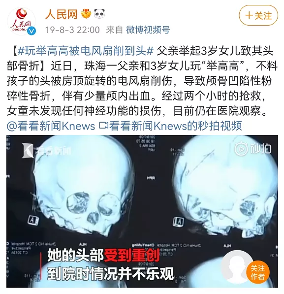 爸爸舉高高失手將1歲半兒子摔進ICU：腦子黑了一半，恐成植物人…