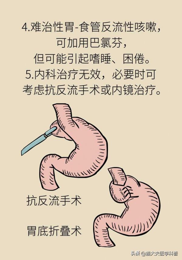 長期慢性咳嗽怎麼回事？（上）