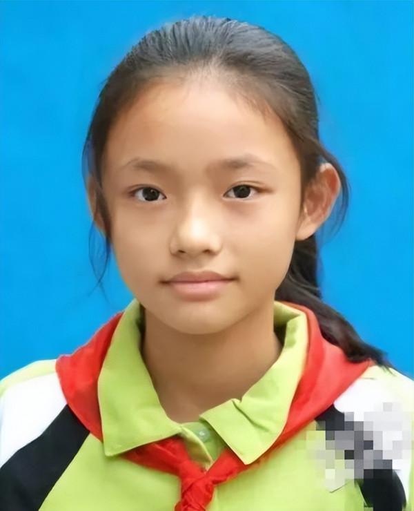 “星女郎”林允曬微整影片，針孔滲血珠，臉部浮腫，網友：太狠了