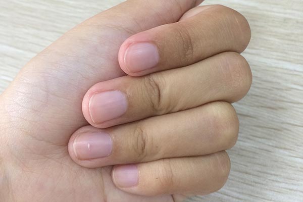 身上三個部位“髒點”更健康，別手欠，過度清潔沒好處