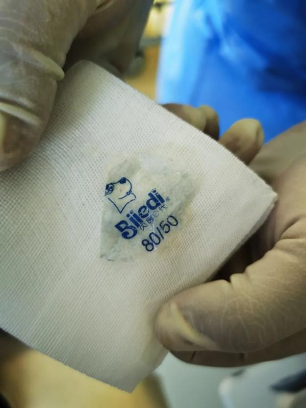 揪心丨寧夏9個月大嬰兒窒息，醫生竟從氣管中取出一團衣服標籤