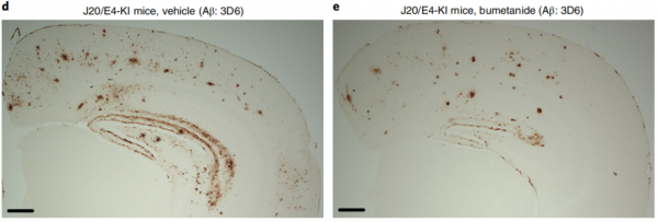 《自然》子刊：阿爾茨海默病的解答早已出現？老藥布美他尼可以逆轉AD相關神經元轉錄組特徵和表現，與患AD風險最高降低75%有關