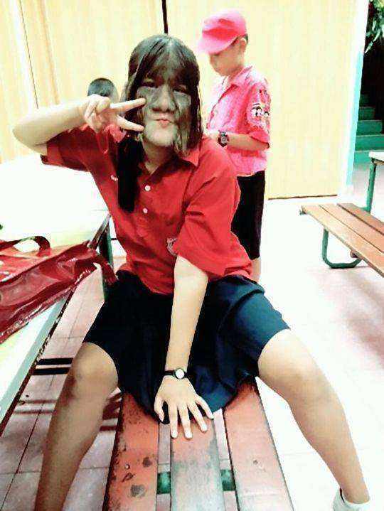 泰國女孩臉上長滿毛髮，長相特殊受盡嘲諷，父母卻視她為掌上明珠