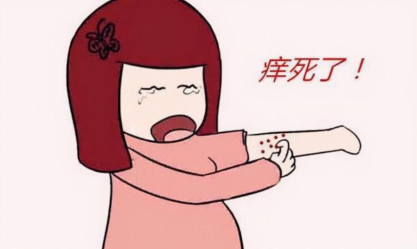 癢癢癢！教你幾個遠離冬季面板瘙癢小妙招