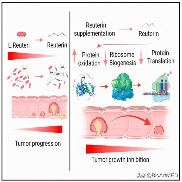 Cancer Cell |“變糞為寶”,腸道菌群代謝物治療結直腸癌 Cancer Cell |“變糞為寶”,腸道菌群代謝物治療結直腸癌
