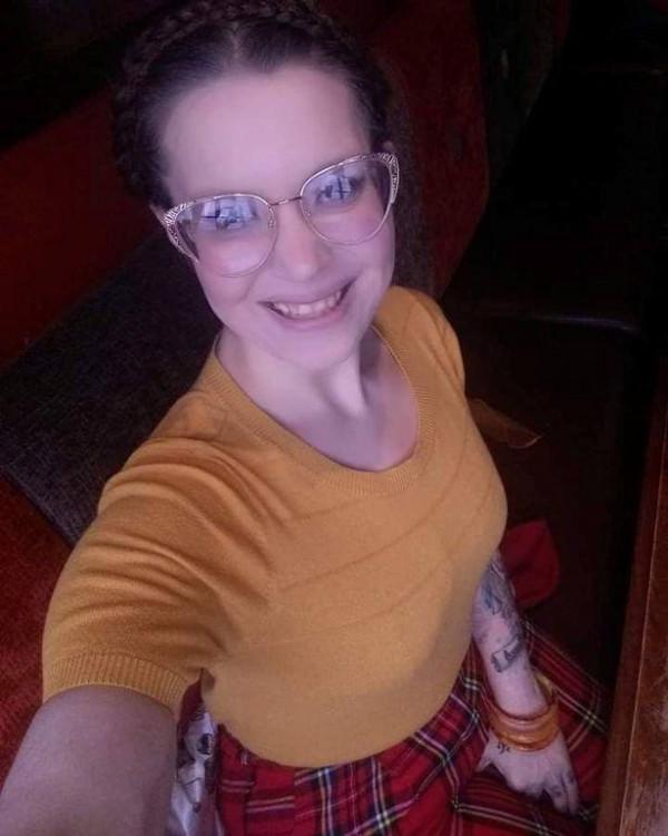 英國29歲女子成功減肥89公斤，現眾籌31萬去除鬆弛下垂的面板