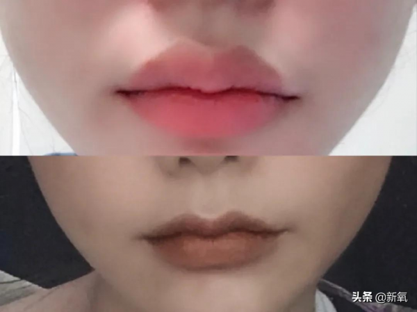 她這眼睛，好像上紅毯前臨時去割的哦...