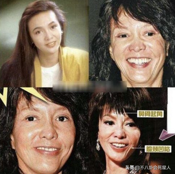 中年女星整容後遺症一堆！臉像鞋拔子，不敢做大表情，演戲沒法看