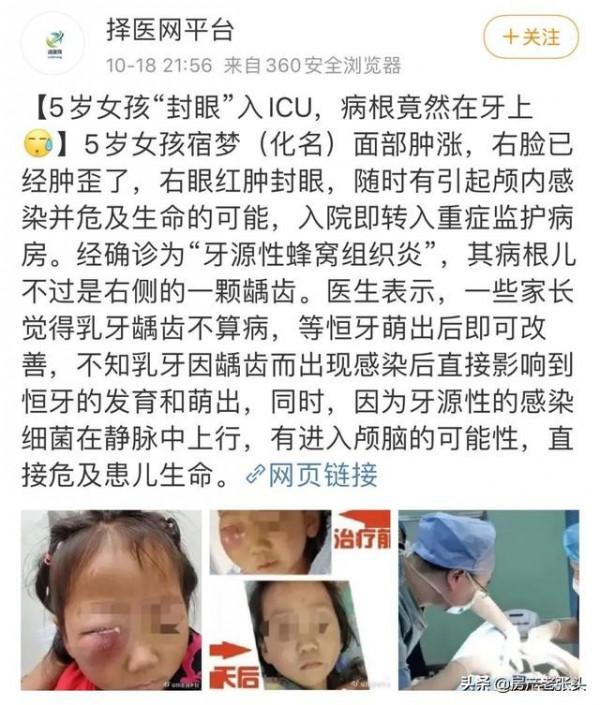 三歲孩子治牙,結果命喪治療室,誰的責任? 三歲孩子治牙,結果命喪治療室,誰的責任?