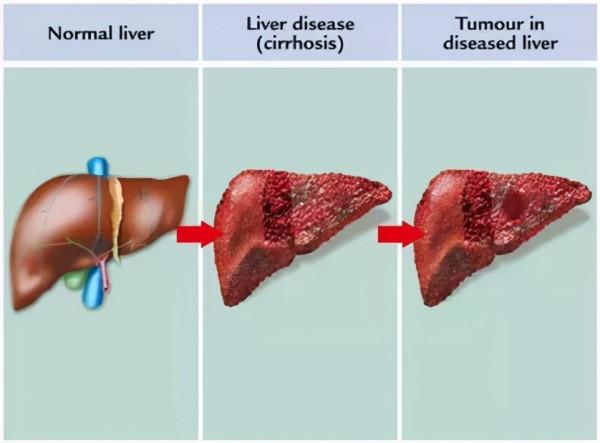 中醫生物養生療法在腫瘤治療過程中的定位在哪? 中醫生物養生療法在腫瘤治療過程中的定位在哪?