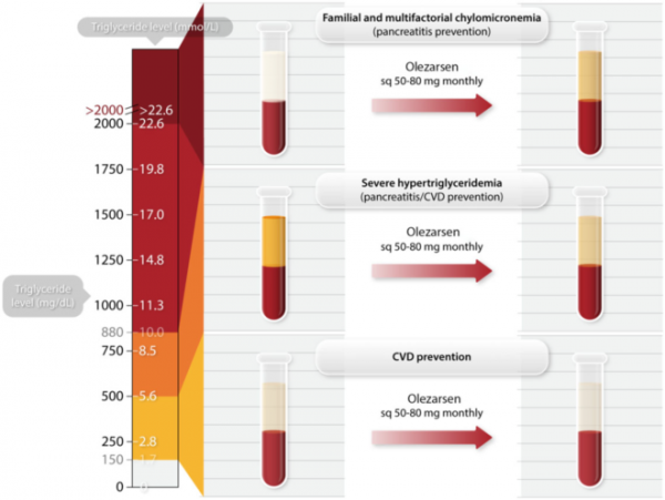 進展 &vert; Olezarsen抑制載脂蛋白C-Ⅲ生成，對中度高甘油三酯血癥和心血管疾病高危患者的影響