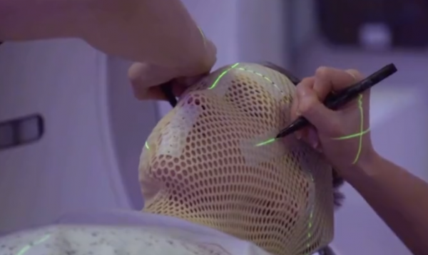 耗資21億的工程：英國15歲小夥腫瘤擴散，不動一刀5分鐘切除腫瘤