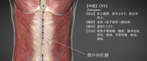 中脘穴—小兒疳積等病證 中脘穴—小兒疳積等病證