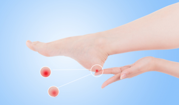 讓人飽受折磨的足跟痛是頑疾？試試這3個方法，輕鬆緩解疼痛