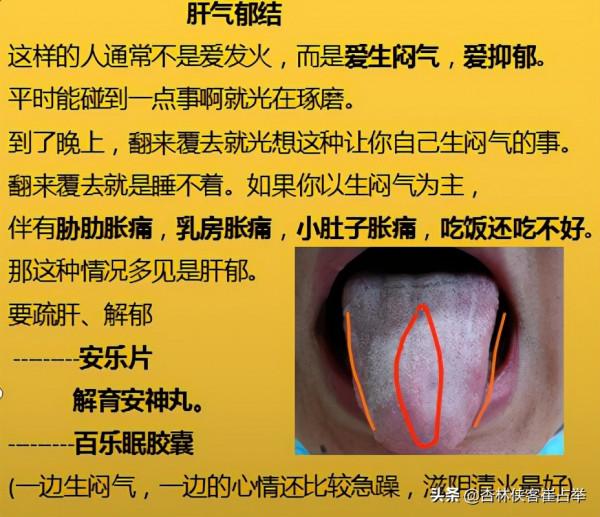 治療失眠的中成藥大總結,失眠、多夢、入睡困難再也不怕用錯藥 治療失眠的中成藥大總結,失眠、多夢、入睡困難再也不怕用錯藥