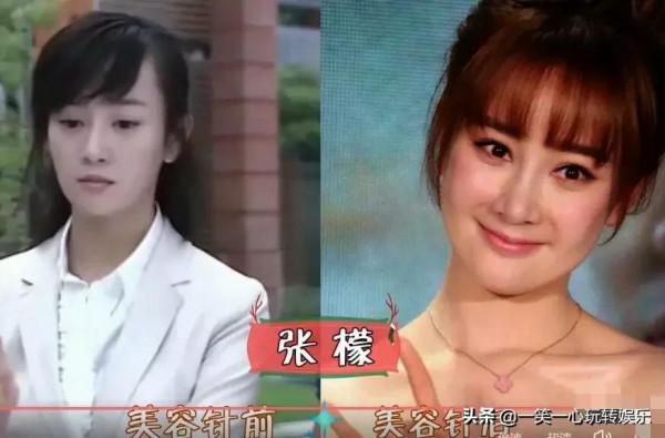 被“美容針”摧殘的女星，戚薇笑都不自然，舒暢真成“天山童姥”