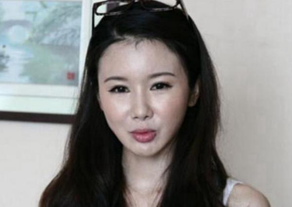 10位“整容過度”的女星：舒暢張檬畫蛇添足，黃夏惠變“鞋拔臉”