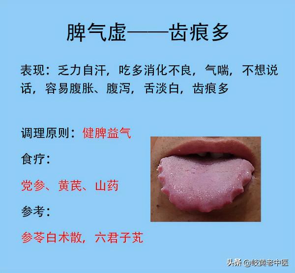 五臟常見的8種虛,臨床的表現和對應解決方法分享 五臟常見的8種虛,臨床的表現和對應解決方法分享