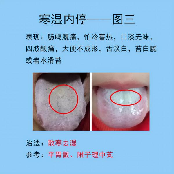 脾胃常見的10種舌象,以及臨床表現,後面帶解決方法 脾胃常見的10種舌象,以及臨床表現,後面帶解決方法