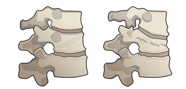 喝骨頭湯不補鈣！再次強調：多吃4種補鈣食物，預防骨質疏鬆