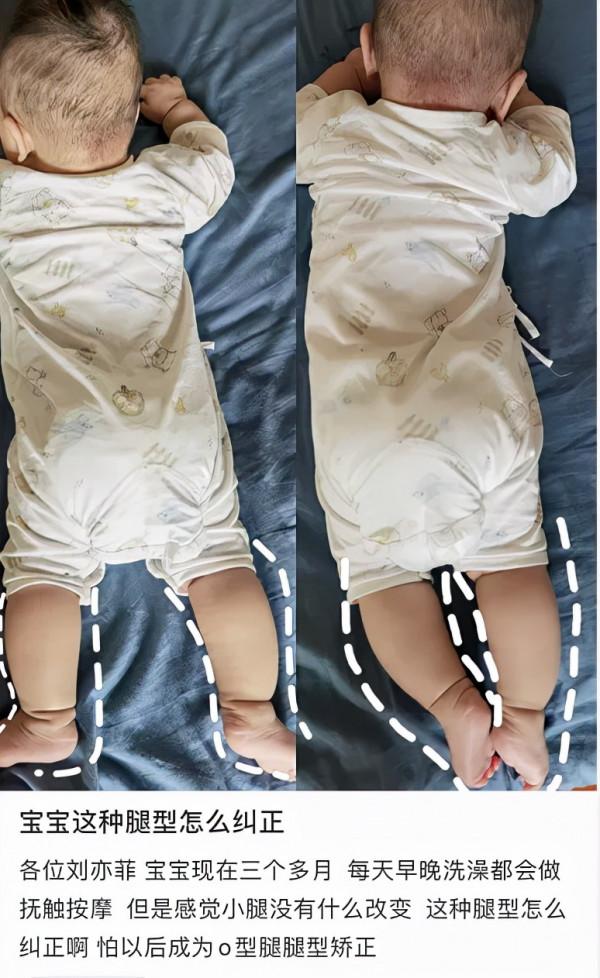 家長界內卷天花板——寧可冒著終身殘疾的風險,也要孩子長高 家長界內卷天花板——寧可冒著終身殘疾的風險,也要孩子長高